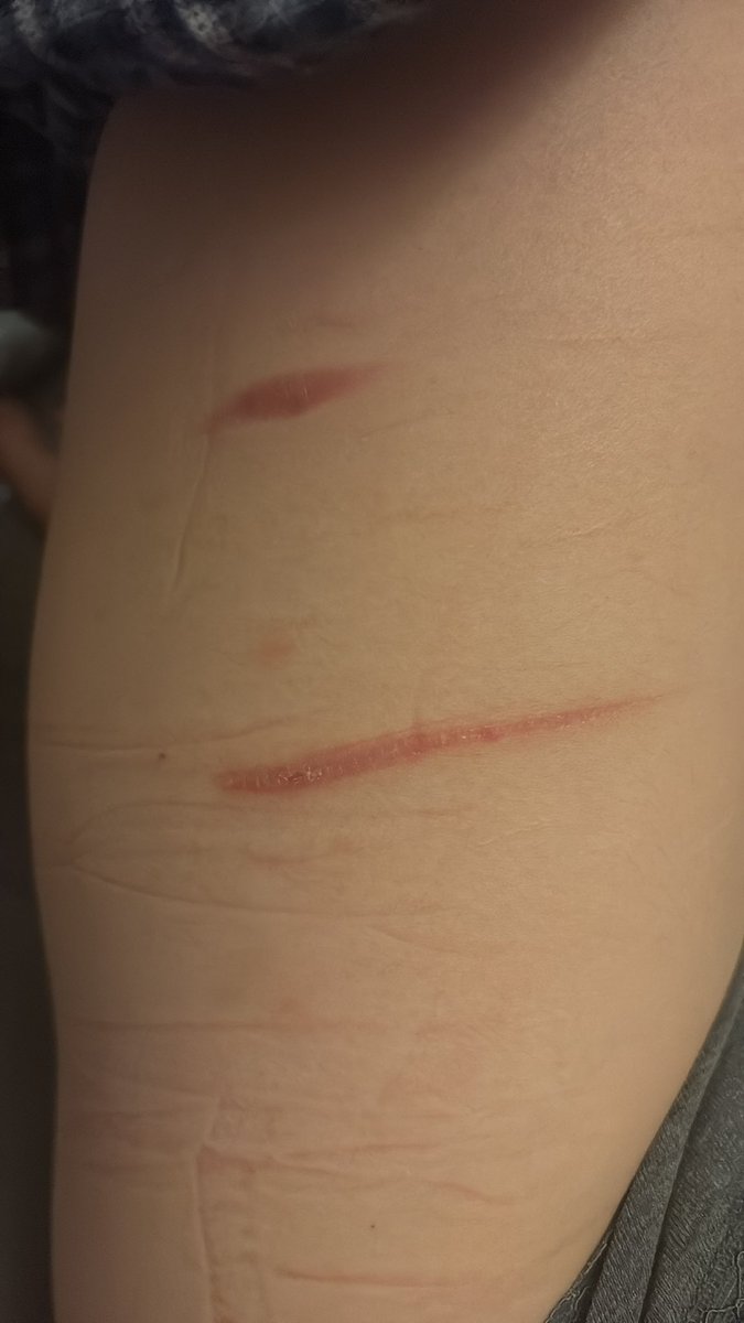 Post attachment